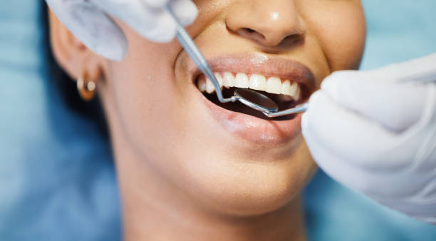 Best Emergency Root Canal Treatment in Valdosta, GA