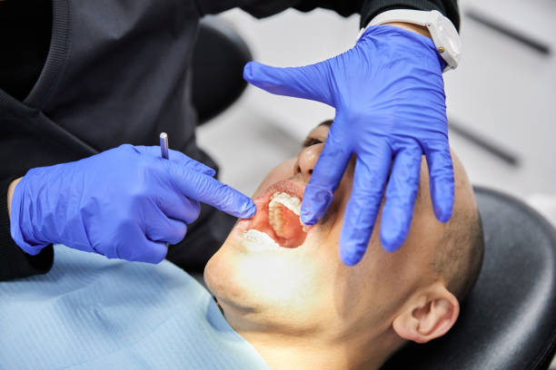 Best Emergency Dentist for Knocked-Out Tooth in Valdosta, GA